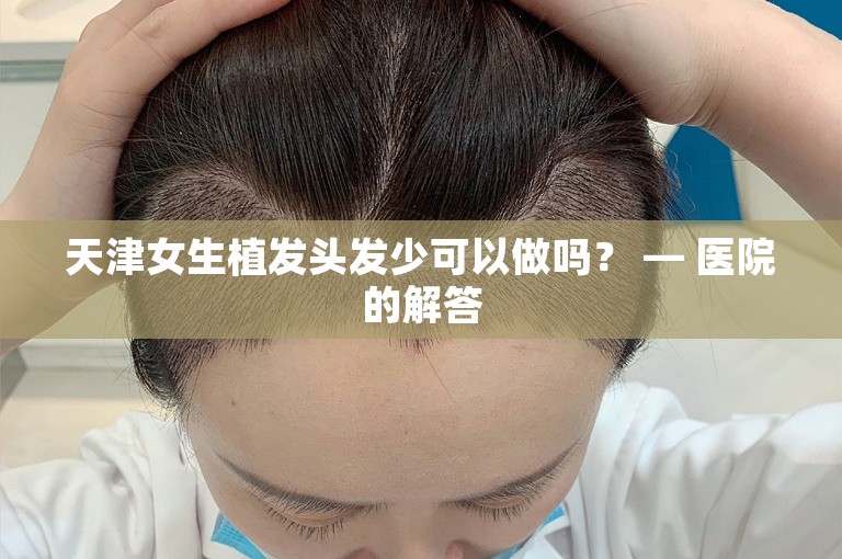 天津女生植发头发少可以做吗？ — 医院的解答