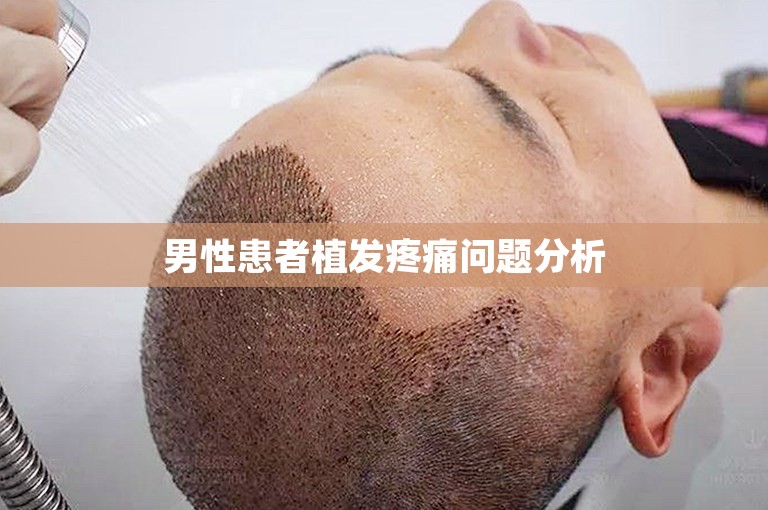 男性患者植发疼痛问题分析