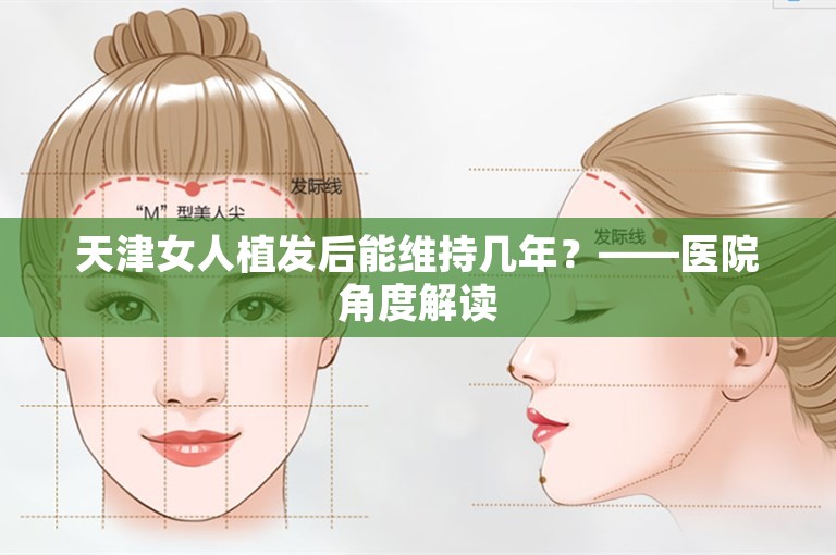 天津女人植发后能维持几年？——医院角度解读