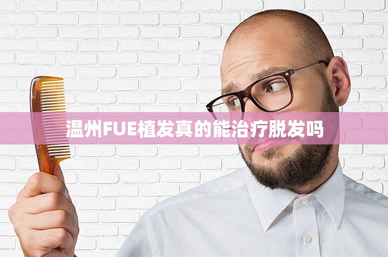 温州FUE植发真的能治疗脱发吗