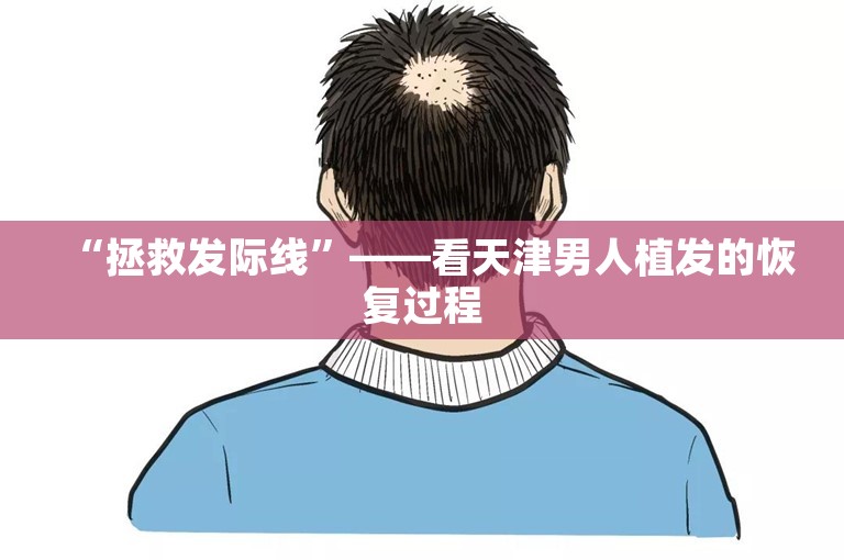 “拯救发际线”——看天津男人植发的恢复过程