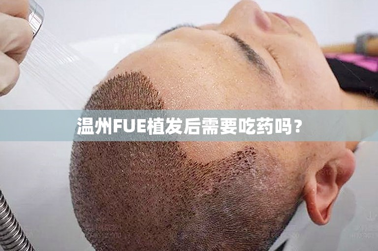 温州FUE植发后需要吃药吗？