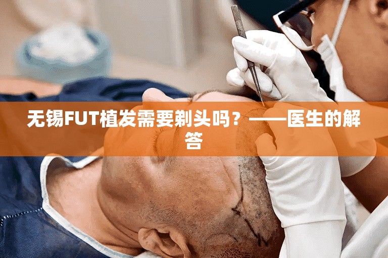 无锡FUT植发需要剃头吗？——医生的解答