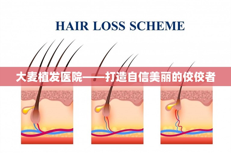 大麦植发医院——打造自信美丽的佼佼者