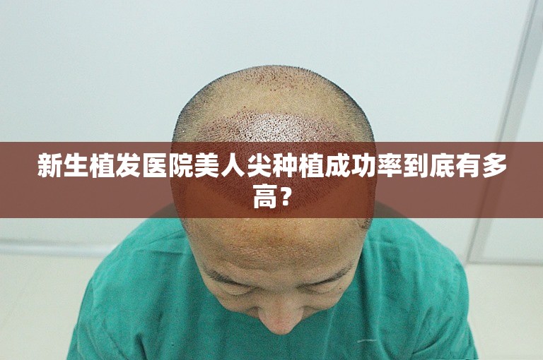 新生植发医院美人尖种植成功率到底有多高？