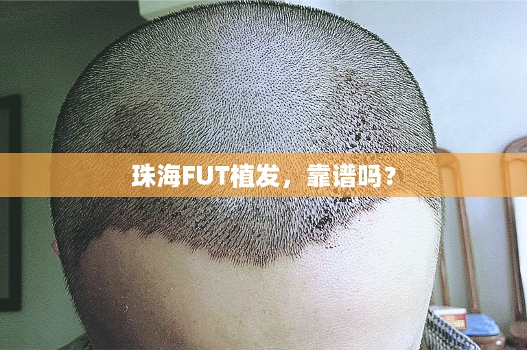 珠海FUT植发，靠谱吗？