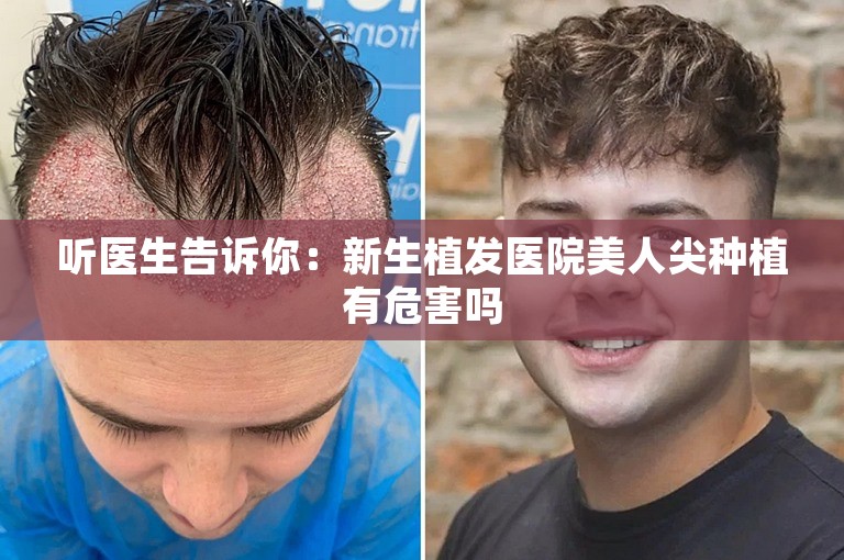 听医生告诉你：新生植发医院美人尖种植有危害吗