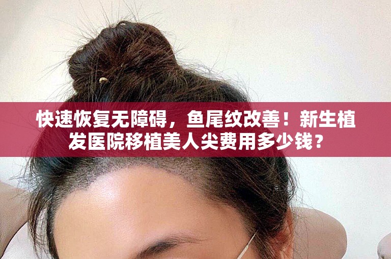 快速恢复无障碍，鱼尾纹改善！新生植发医院移植美人尖费用多少钱？