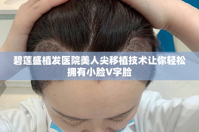 碧莲盛植发医院美人尖移植技术让你轻松拥有小脸V字脸