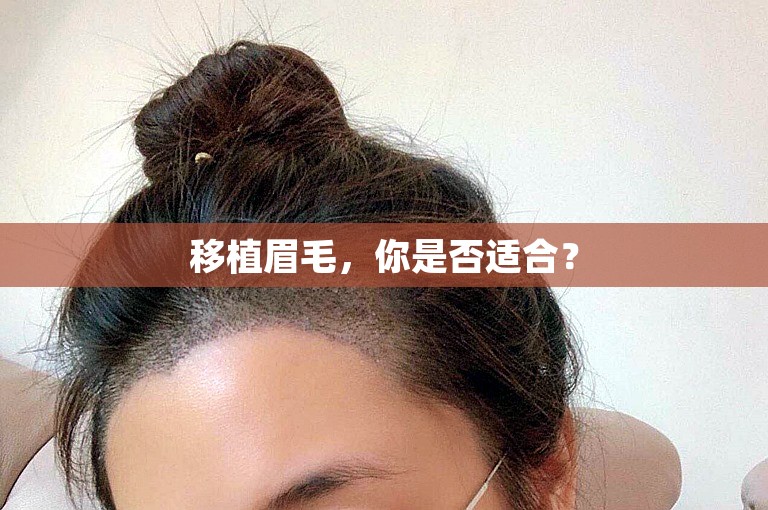 移植眉毛，你是否适合？