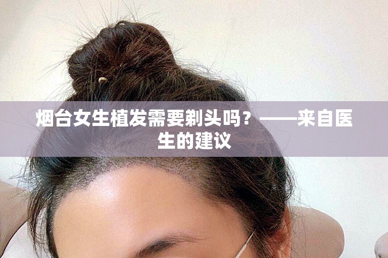 烟台女生植发需要剃头吗？——来自医生的建议