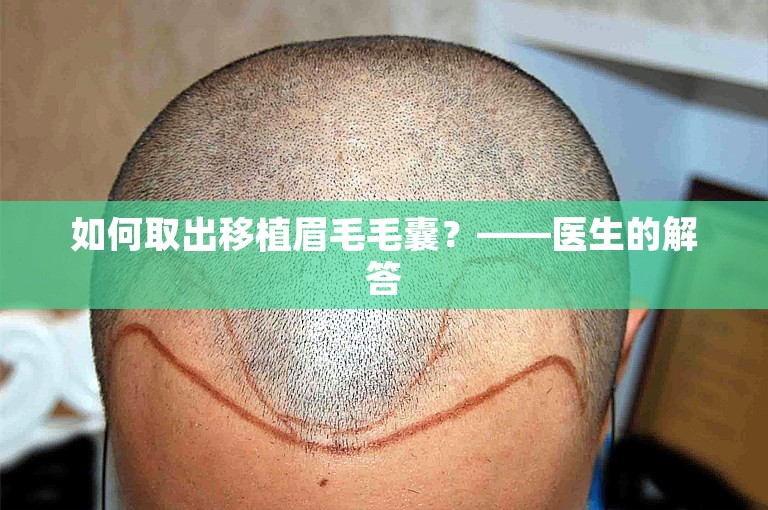 如何取出移植眉毛毛囊？——医生的解答