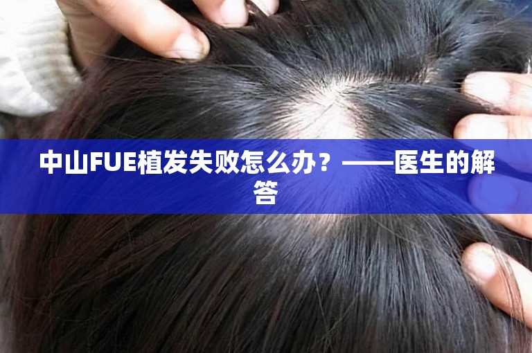 中山FUE植发失败怎么办？——医生的解答