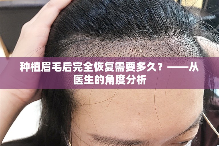 种植眉毛后完全恢复需要多久？——从医生的角度分析