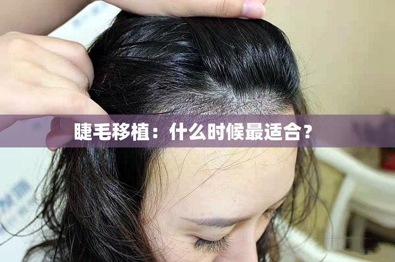  睫毛移植：什么时候最适合？ 