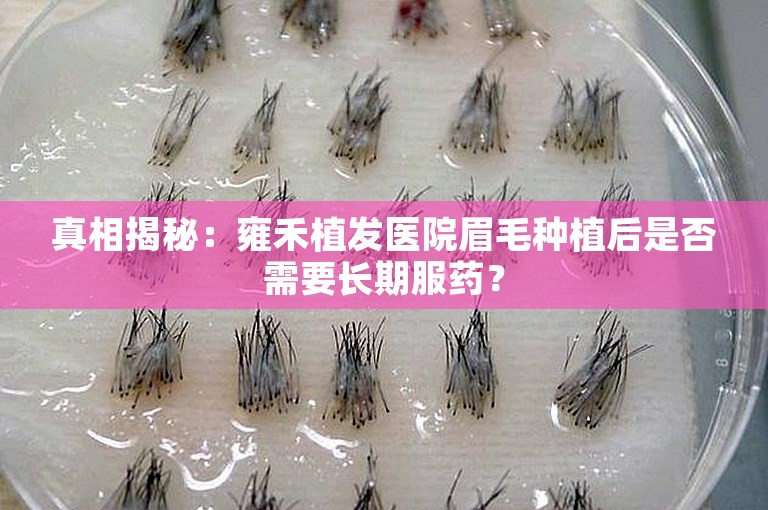 真相揭秘：雍禾植发医院眉毛种植后是否需要长期服药？