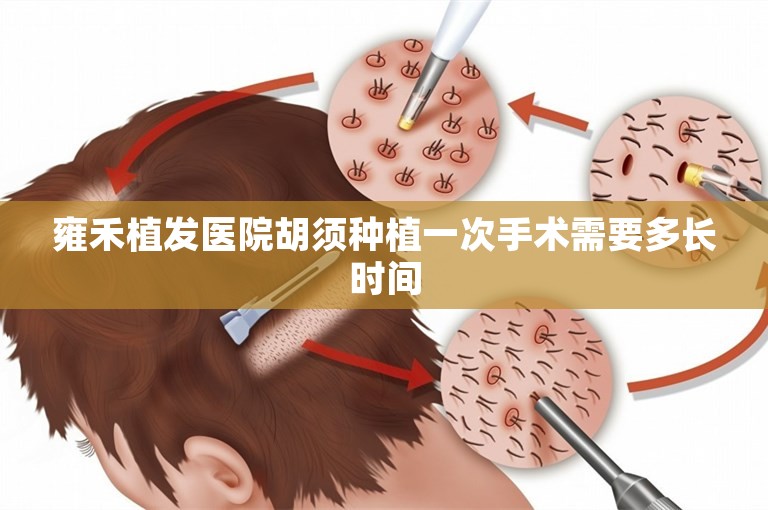 雍禾植发医院胡须种植一次手术需要多长时间