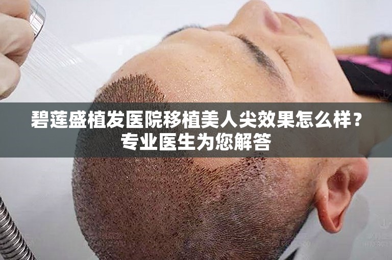 碧莲盛植发医院移植美人尖效果怎么样？专业医生为您解答