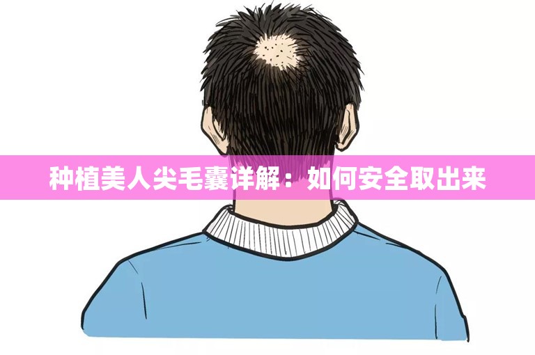 种植美人尖毛囊详解：如何安全取出来