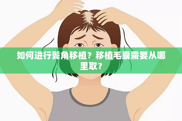 如何进行鬓角移植？移植毛囊需要从哪里取？