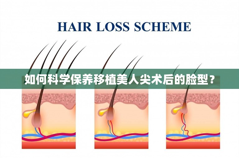 如何科学保养移植美人尖术后的脸型？