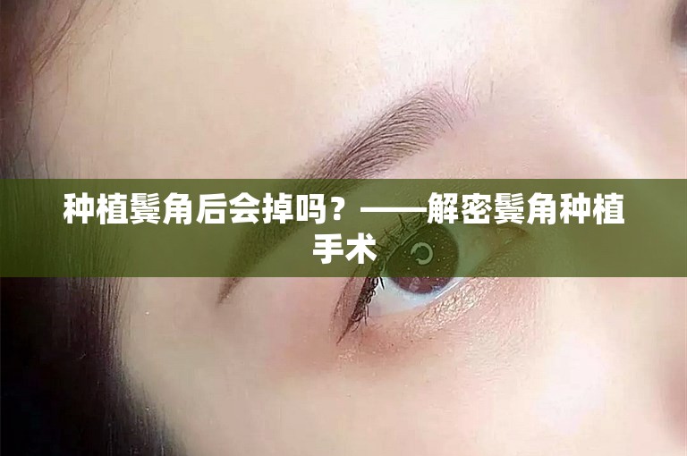 种植鬓角后会掉吗？——解密鬓角种植手术