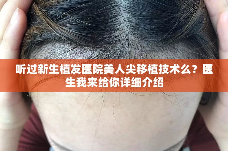 听过新生植发医院美人尖移植技术么？医生我来给你详细介绍