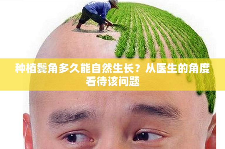 种植鬓角多久能自然生长？从医生的角度看待该问题