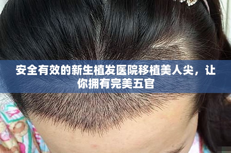 安全有效的新生植发医院移植美人尖，让你拥有完美五官