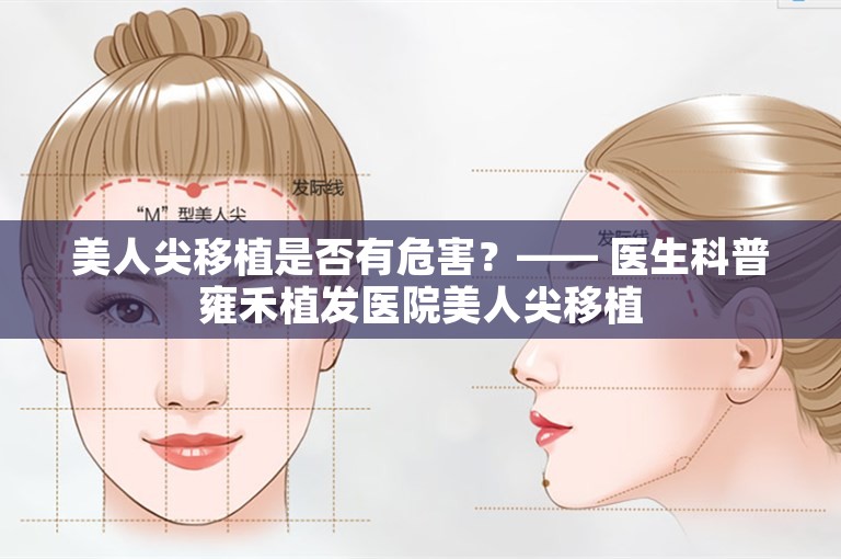 美人尖移植是否有危害？—— 医生科普雍禾植发医院美人尖移植