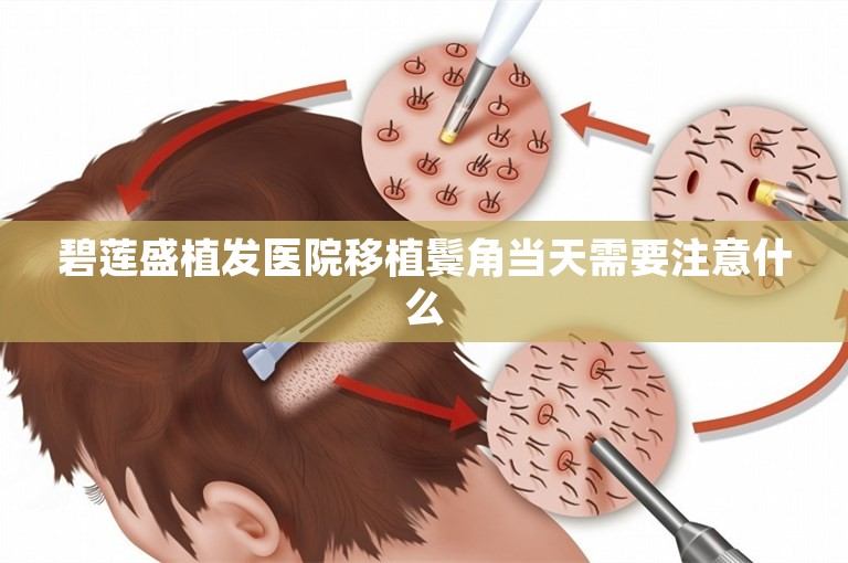 碧莲盛植发医院移植鬓角当天需要注意什么