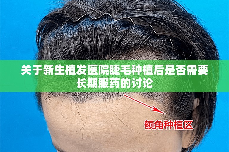 关于新生植发医院睫毛种植后是否需要长期服药的讨论