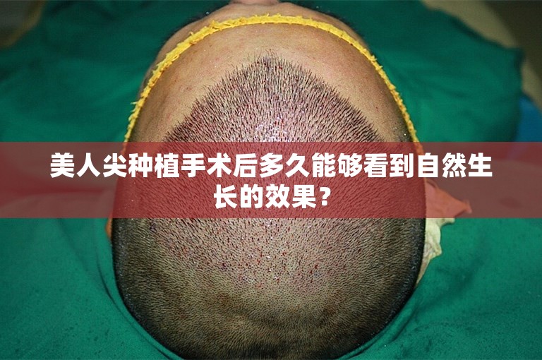 美人尖种植手术后多久能够看到自然生长的效果？