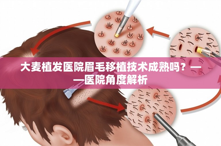 大麦植发医院眉毛移植技术成熟吗？——医院角度解析