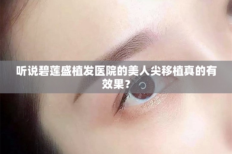 听说碧莲盛植发医院的美人尖移植真的有效果？