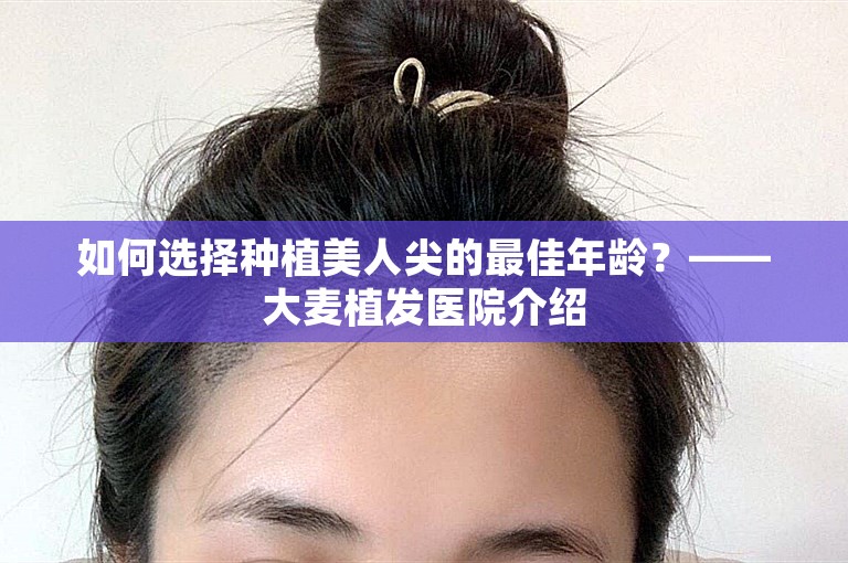 如何选择种植美人尖的最佳年龄？——大麦植发医院介绍