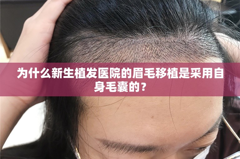 为什么新生植发医院的眉毛移植是采用自身毛囊的？