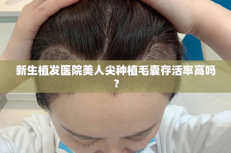 新生植发医院美人尖种植毛囊存活率高吗？