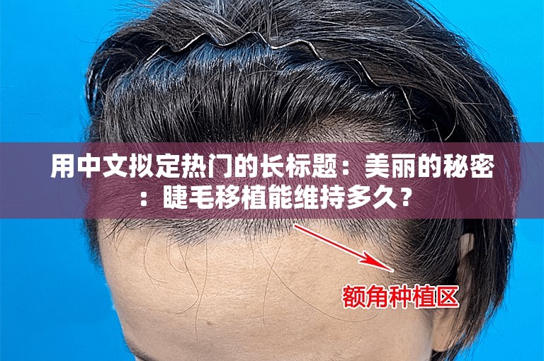 用中文拟定热门的长标题：美丽的秘密：睫毛移植能维持多久？