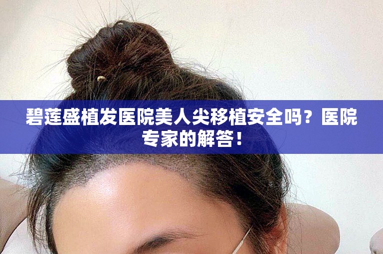 碧莲盛植发医院美人尖移植安全吗？医院专家的解答！