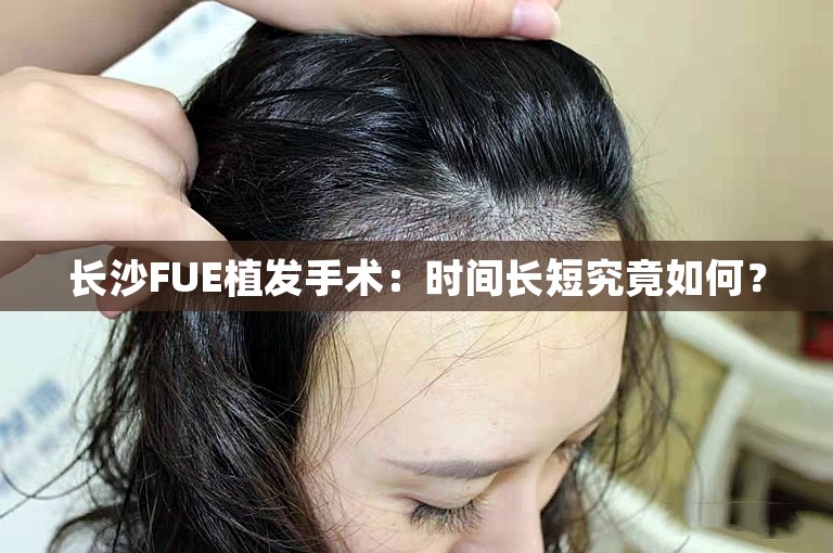 长沙FUE植发手术：时间长短究竟如何？