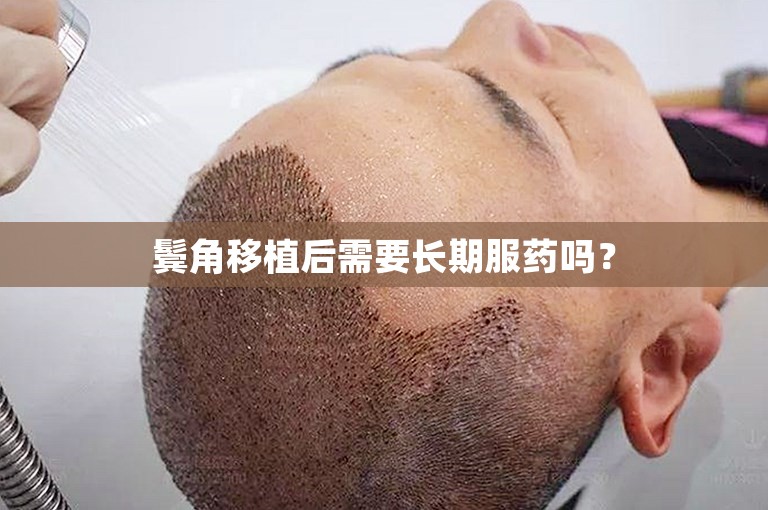 鬓角移植后需要长期服药吗？