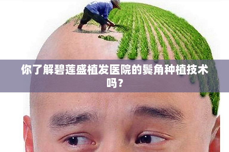 你了解碧莲盛植发医院的鬓角种植技术吗？