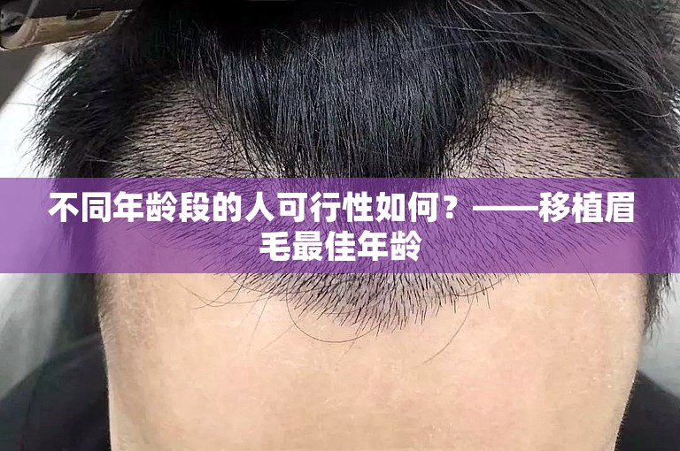 不同年龄段的人可行性如何？——移植眉毛最佳年龄