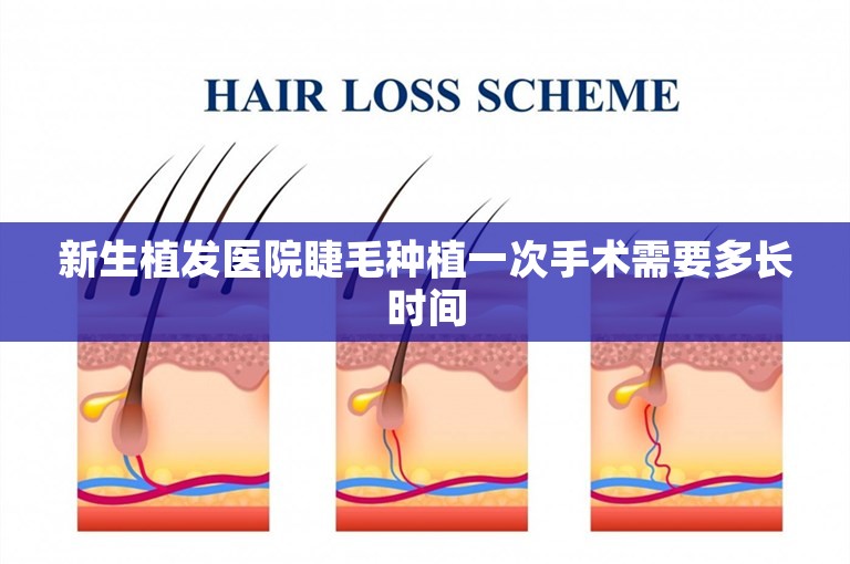 新生植发医院睫毛种植一次手术需要多长时间