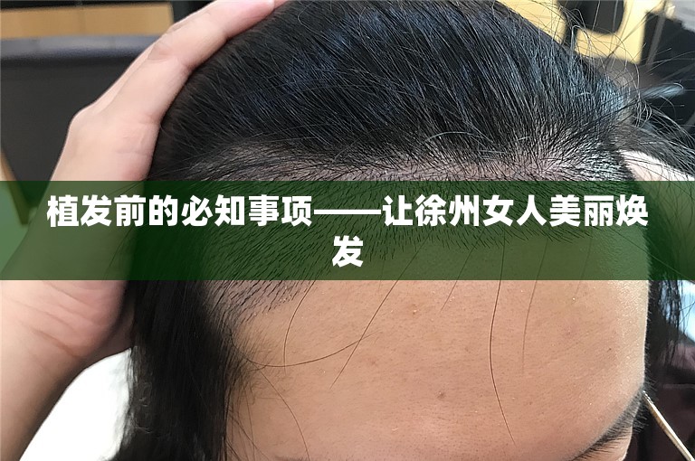 植发前的必知事项——让徐州女人美丽焕发