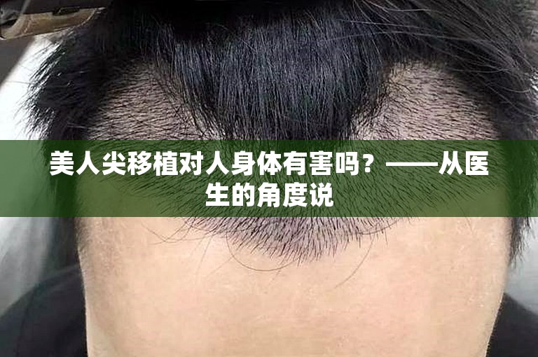 美人尖移植对人身体有害吗？——从医生的角度说