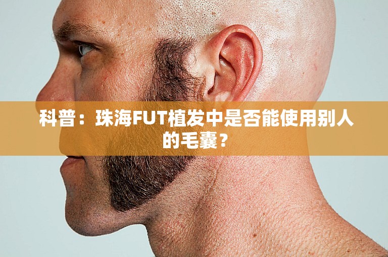  科普：珠海FUT植发中是否能使用别人的毛囊？