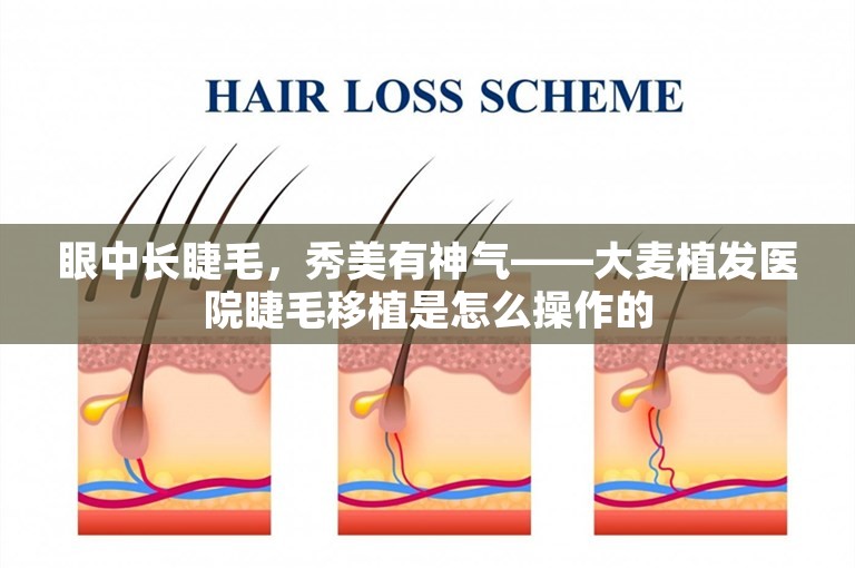 眼中长睫毛，秀美有神气——大麦植发医院睫毛移植是怎么操作的