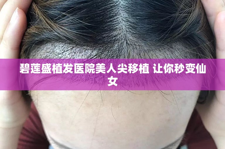 碧莲盛植发医院美人尖移植 让你秒变仙女